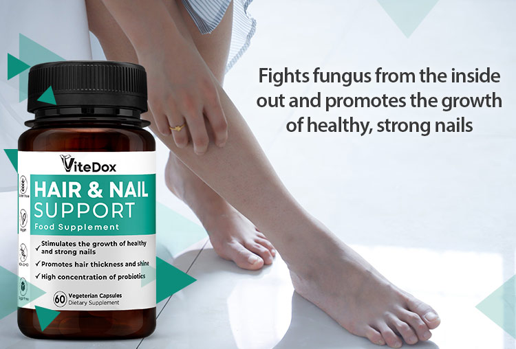 ViteDox Hair & Nail Support | Food Supplement
